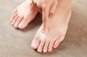 Виды грибка ногтей на ногах и их лечение