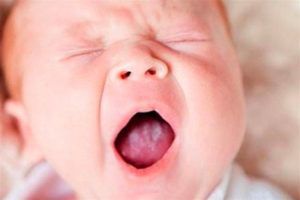 Молочница на языке у ребенка 3 года thumbnail
